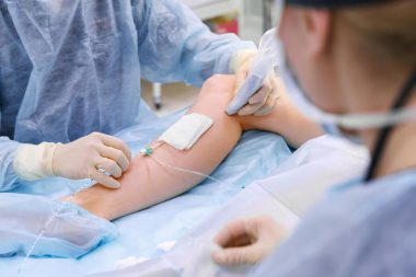 endovenous laser therapy