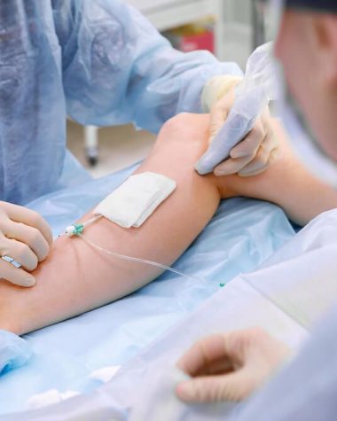 endovenous laser therapy